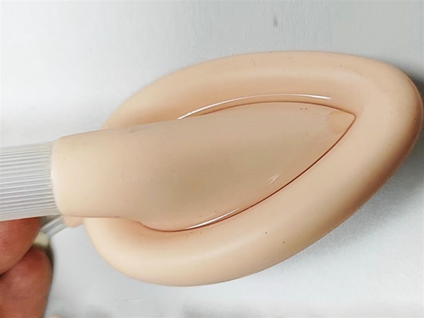 喉（hóu）罩外部粘接