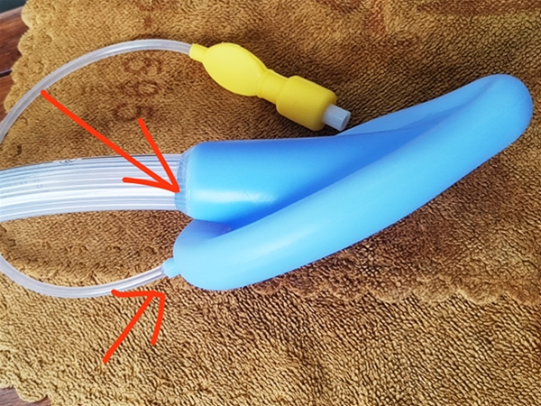 喉罩與矽膠管接（jiē）頭（tóu）粘接